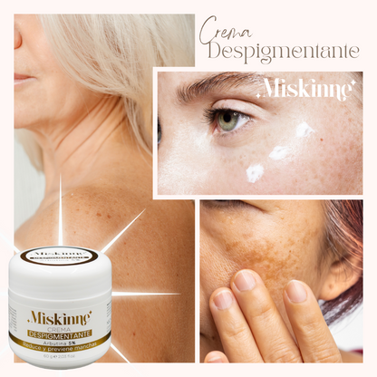 Miskinne - Crema reductora de manchas + Ebook Gratis